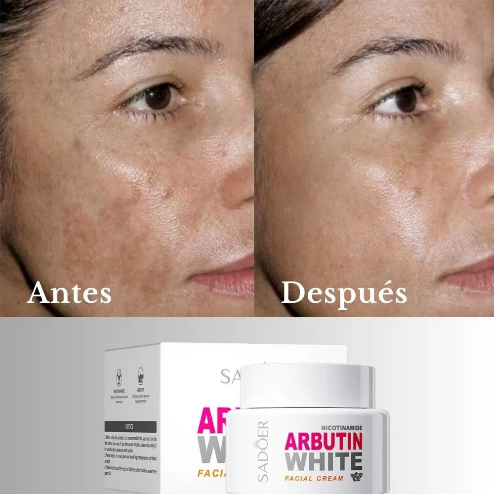 LA CREMA ANTIMANCHAS # 1 ORIGINAL 😍 Aclara, Hidrata y Rejuvenece OFERTA